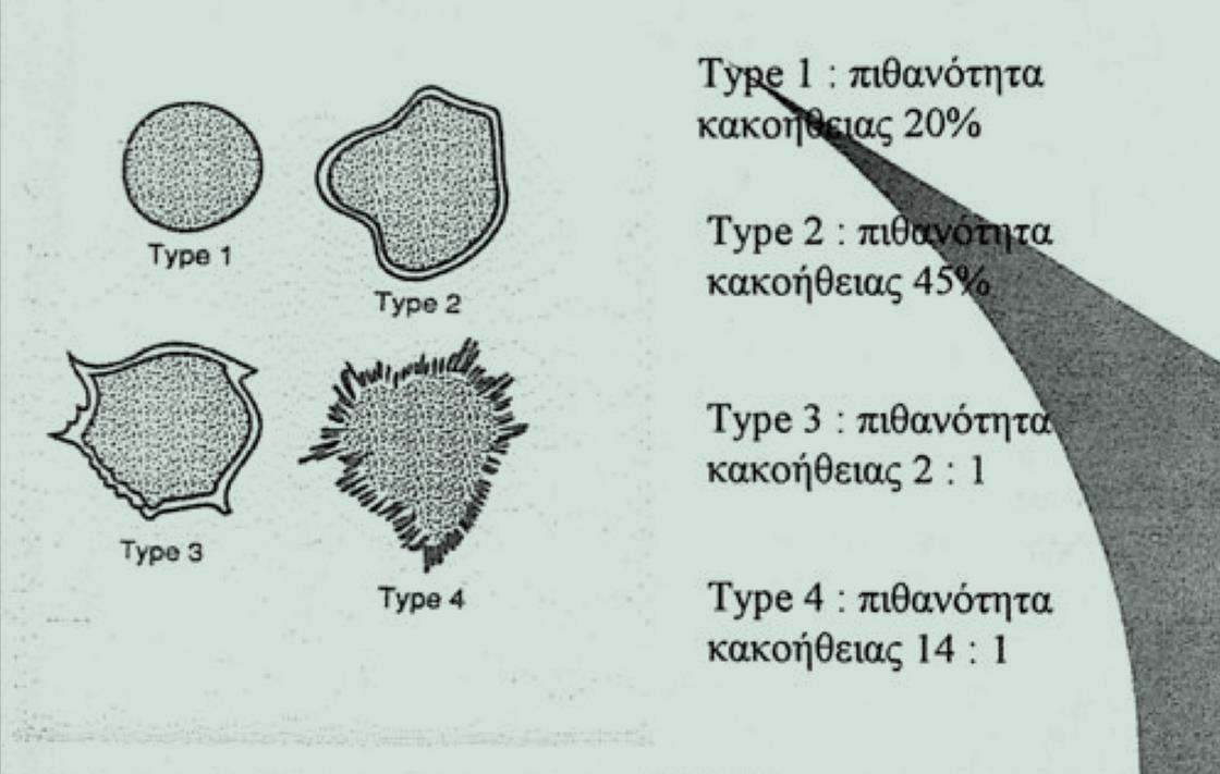 Το χει λος Περι γραμμα του ο ζου 1. Τα ομαλα χει λη προδιαθε τουν για καλοήθη βλα βη (79%).