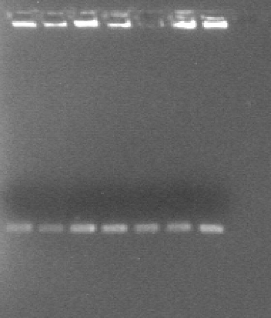 Ηλεκτροφόρηση σε αγαρόζη των προϊόντων PCR για το γονίδιο vana εκκινητές: vana1: 5 -atg gca agt cag gtg aag atg g-3
