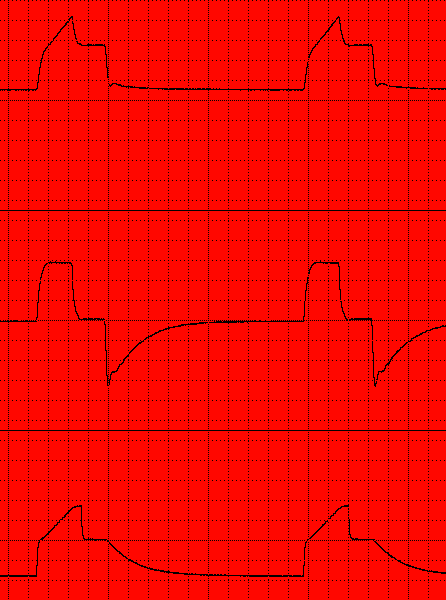 Monitoring Plateau pressure C= 40, R=10 C= 20, R=10 30cmH2O Paw 0 Paw