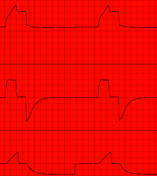 Καμπύλη Ροής Χρόνου 30cmH2O 0 0 COPD