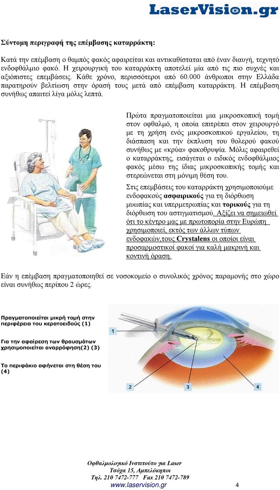 000 άνθρωποι στην Ελλάδα παρατηρούν βελτίωση στην όρασή τους μετά από επέμβαση καταρράκτη. Η επέμβαση συνήθως απαιτεί λίγα μόλις λεπτά.