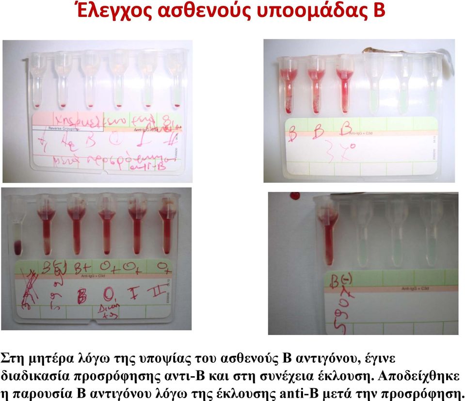 αντι-β και στη συνέχεια έκλουση.