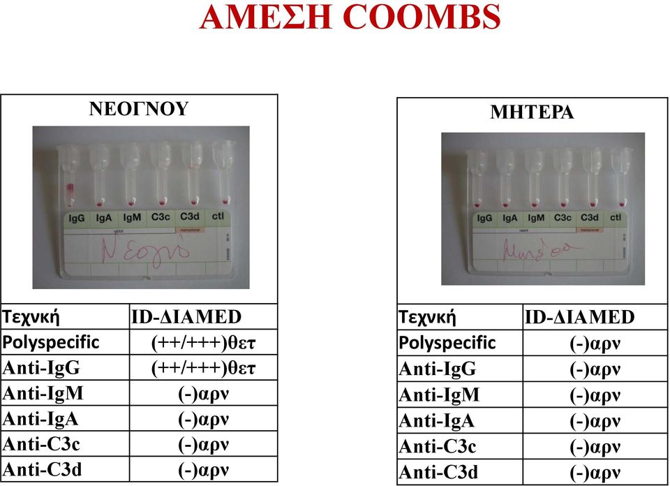 ID-ΔIAMED (++/+++)θετ (++/+++)θετ Τεχνκή