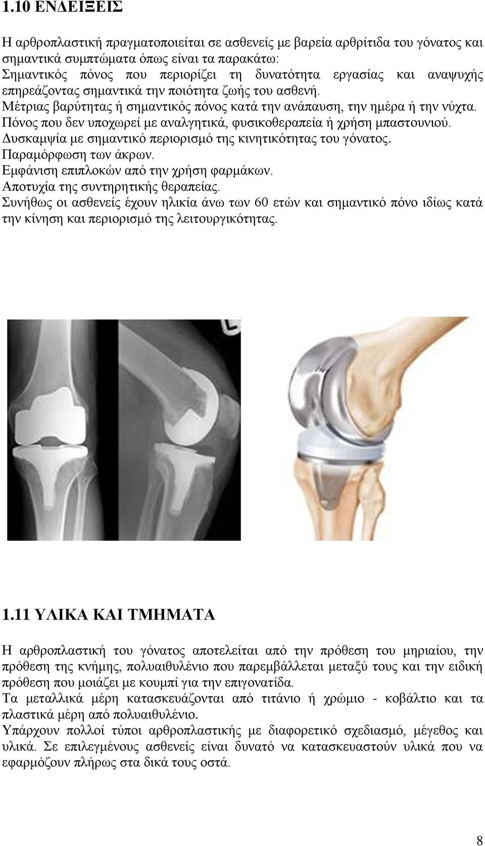 Πόλνο πνπ δελ ππνρσξεί κε αλαιγεηηθά, θπζηθνζεξαπεία ή ρξήζε κπαζηνπληνύ. Γπζθακςία κε ζεκαληηθό πεξηνξηζκό ηεο θηλεηηθόηεηαο ηνπ γόλαηνο. Παξακόξθσζε ησλ άθξσλ.