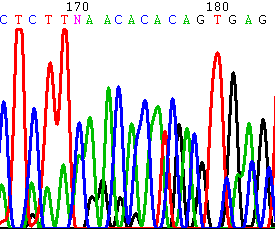 Aπεικόνιση των 2 σημειακών μεταλλάξεων του γονιδίου KAL1 που εντοπίστηκαν στον ασθενή με