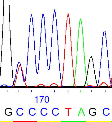 Pro146Ser ΑΔΕΛΦΕΣ ΜΗΤΕΡΑ GA