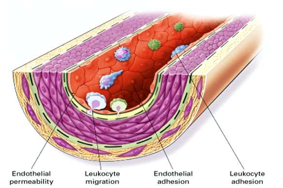 Stress & Inflammation CV Disease Ross. N Engl J Med.