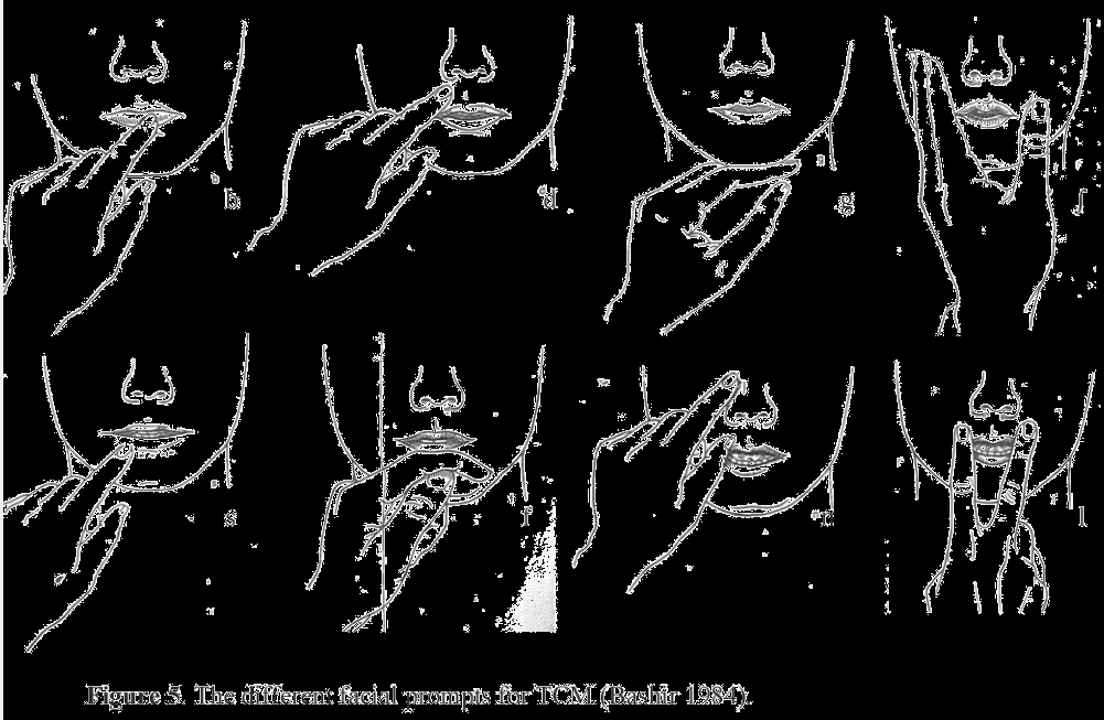 The Touch-Cue Method (TCM) Μέθοδος άγγιγμα-υπόδειξη 8 σημεία υπόδειξης Εάν το παιδί παρουσιάσει δυσκολία στην εκφώνηση συμφώνου, ο