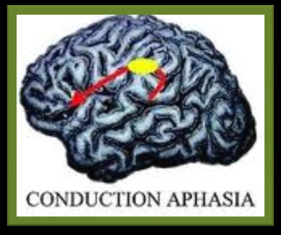 AΦΑΣΙΑ ΑΓΩΓΗΣ(CONDUCTION APHASIA) Σχετικά σπάνια αφασία Καλή κατανόηση του προφορικού και γραπτού λόγου Δυσκολία εύρεσης