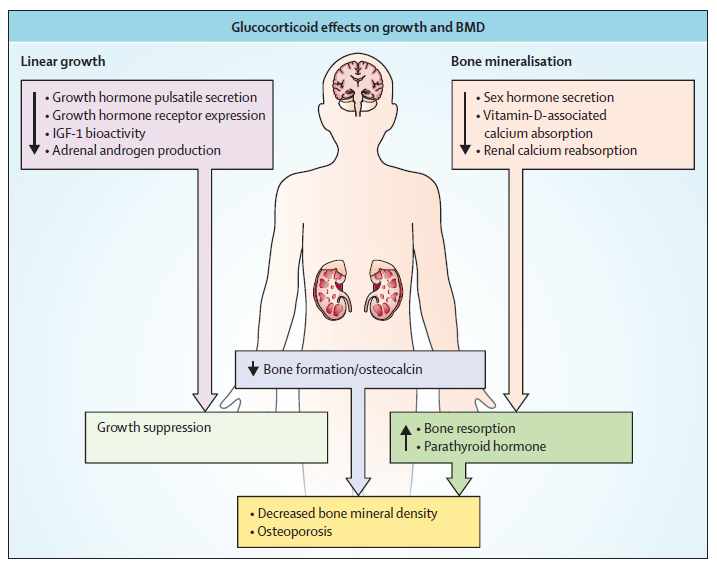 Fuhlbrigge AL, Kelly HW The Lancet Respiratory medicine 2014