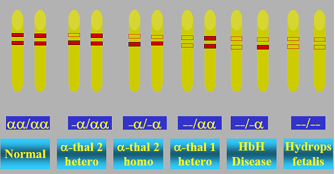 Χρ. 16 α-θαλασσαιμία Ασυμπτωματικά (σιωπηλός φορέας) Σχεδόν ασυμπτωματικά (φορέας α- θαλασσαιμίας) Μέτρια-σοβαρή Ασύμβατο με τη ζωή