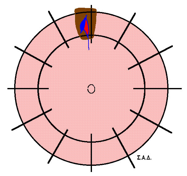 15.14.-16. Μοσχεύματα και παραμόρφωση του βολβού Χ.Π.,, 62 Α.Ο., φ o.o.: μ.δ. 30 cm PVR: B ρωγμή πλάτους 8mm (6-14 mm από το limbus) κάτω από τον άνω ορθό μυ Εικ 15.