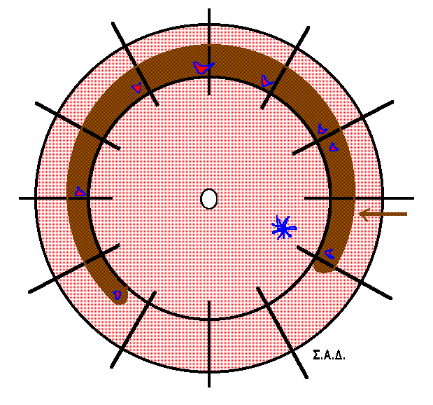 Α.Π.,, 49 Δ.Ο., φ ο.ο.: μ.δ. 30 cm ( - 7,25 = - 2,5 / 60 ) υψηλή μυωπία, PVR: C 1 πολλαπλές ρωγμές κατά το αυτό γεωγραφικό πλάτος Εικ 15.