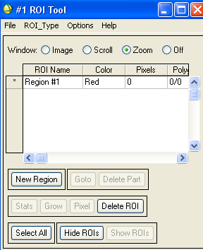 Φορτώστε την εικόνα 543 (αν δεν την έχετε ήδη) και από το μενού της κύριας εικόνας επιλέξτε Tools > Region of Interest > ROI Tool (εναλλακτικά από το βασικό μενού Basic Tools > Region of Interest >