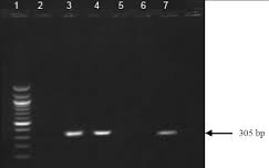 Ανάλυση του προϊόντος της PCR με ηλεκτροφόρηση σε πήκτωμα αγαρόζης 1: Τμήματα DNA γνωστού Μεγέθους (μάρτυρας μεγεθών) 2: Αρνητικός μάρτυρας (δεν περιέχει