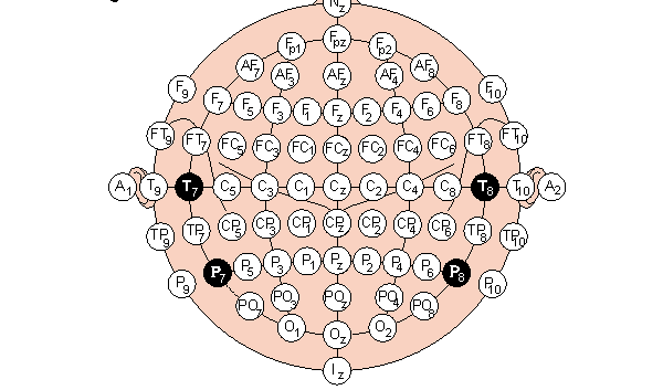 Εικόνα 3: Τα ονόματα των ηλεκτροδίων προκύπτουν από τη θέση τους δηλαδή F(frontal),C(central), T(temporal), P(parietal), O(occipital) για τον πρόσθιο, κεντρικό, κροταφικό, βρεγματικό και ινιακό λοβό