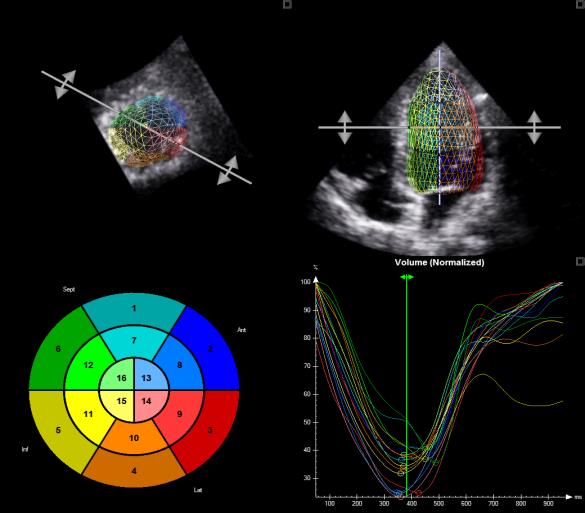 Analysis Volumes and EF