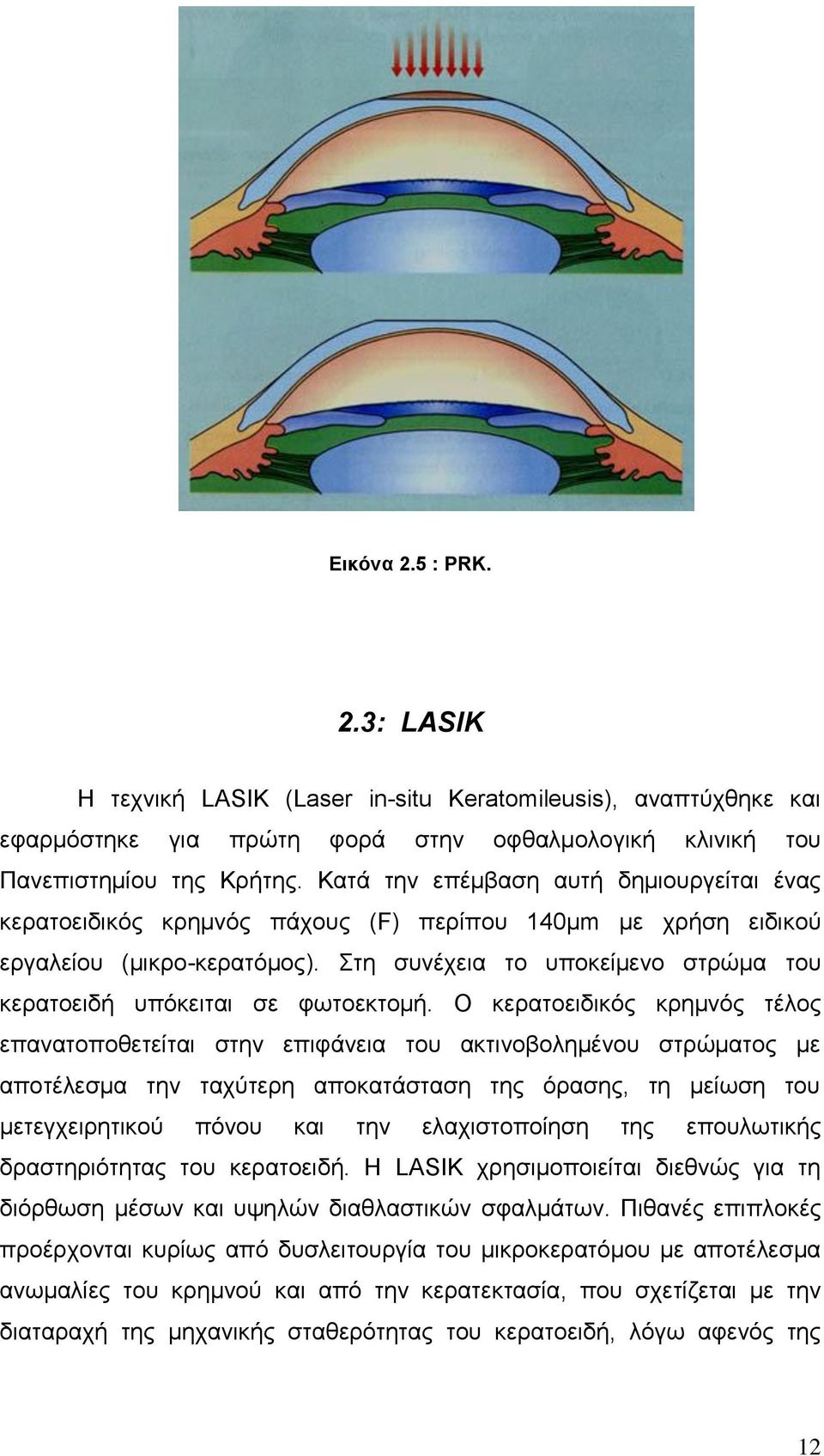 ηε ζπλέρεηα ην ππνθείκελν ζηξώκα ηνπ θεξαηνεηδή ππόθεηηαη ζε θσηνεθηνκή.