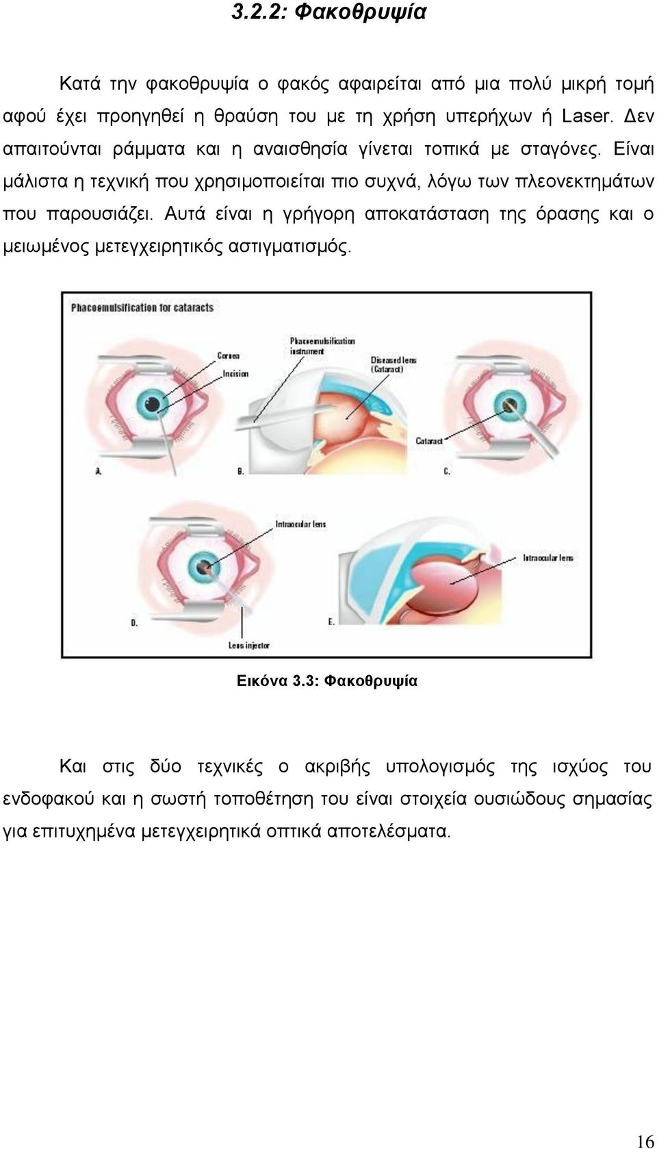 Δίλαη κάιηζηα ε ηερληθή πνπ ρξεζηκνπνηείηαη πην ζπρλά, ιόγσ ησλ πιενλεθηεκάησλ πνπ παξνπζηάδεη.