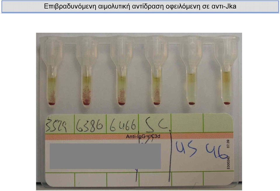 αντίδραση