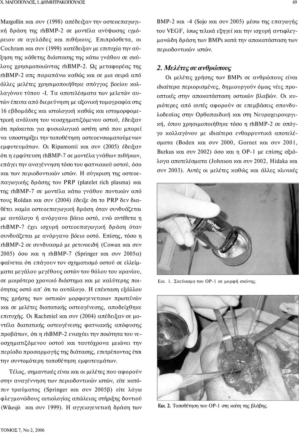 Ως μεταφορέας της rhbmp-2 σπς παραπάνω καθώς και σε μια σειρά από άλλες μελέτες χρησιμοποιήθηκε σπόγγος βοείου κολλαγόνου τύπου -Ι.