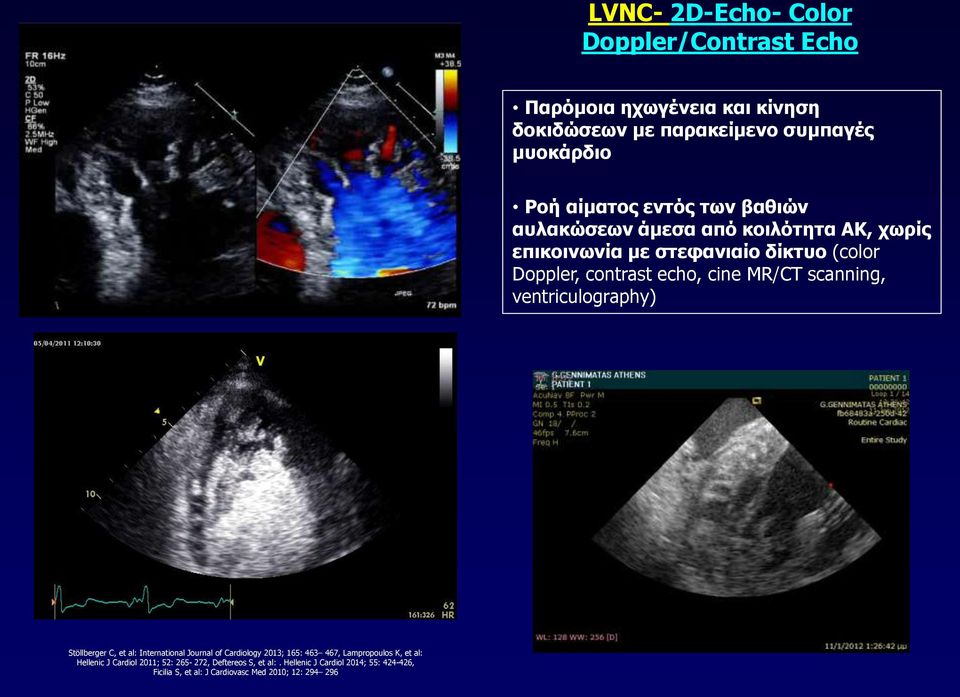 scanning, ventriculography) Stöllberger C, et al: International Journal of Cardiology 2013; 165: 463 467, Lampropoulos K, et al: