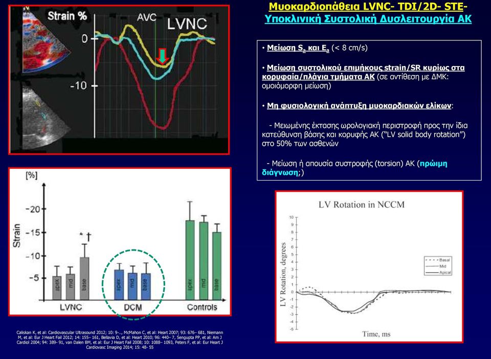 - Μείωση ή απουσία συστροφής (torsion) ΑΚ (πρώιμη διάγνωση;) Caliskan K, et al: Cardiovascular Ultrasound 2012; 10: 9-.