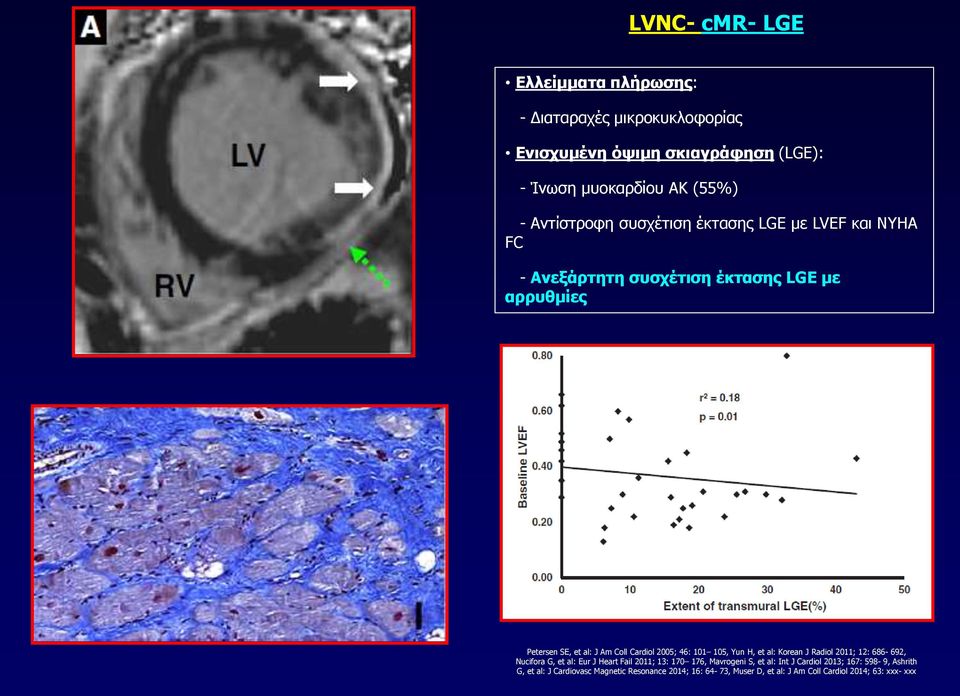 2005; 46: 101 105, Yun H, et al: Korean J Radiol 2011; 12: 686-692, Nucifora G, et al: Eur J Heart Fail 2011; 13: 170 176, Mavrogeni S, et