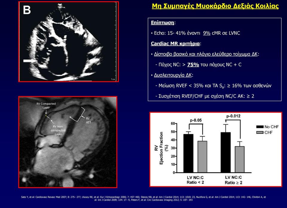 al: Cardiovasc Revasc Med 2007; 8: 275 277, Ulusoy RE, et al: Eur J Echocardiogr 2006; 7: 457 460, Stecey RB, et al: Am J Cardiol 2014; 113: 1018-23,