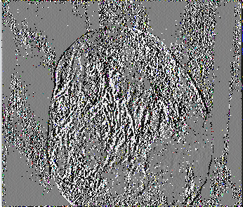 Εικόνα 3. Προσβεβλημένος κόνδυλος πατάτας από τον ψευδομύκητα Phytophthora infestans, επί του οποίου παρατηρείται το σύμπτωμα της ξηρής σήψης.