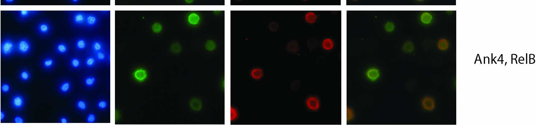 Εικόνα 37. Υποκυτταρικός εντοπισµός των πρωτεϊνών Ank µε τον µεταγραφικό παράγοντα RelB. Ο συνεντοπισµός του µεταγραφικού παράγοντα flag.relb µε τις Ank1, Ank2 ή Ank4 εµφανίζεται στο κυτταρόπλασµα.