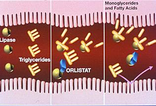 ΦΑΡΜΑΚΕΥΤΙΚΗ ΑΝΤΙΜΕΤΩΠΙΣΗ ΤΗΣ ΠΑΧΥΣΑΡΚΙΑΣ: ΟΡΛΙΣΤΑΤΗ (Xenical ) Αναστολέας παγκρεατικών και εντερικών λιπασών Αποκλεισμός της υδρολύσεως των τριγλυκεριδίων