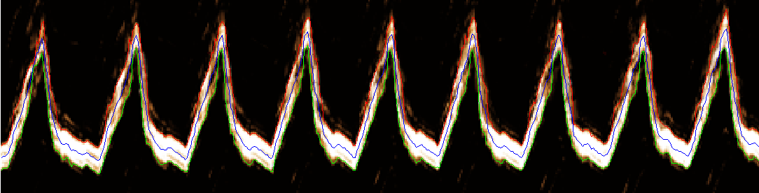 (α) (β) (γ) Εικόνα 4.
