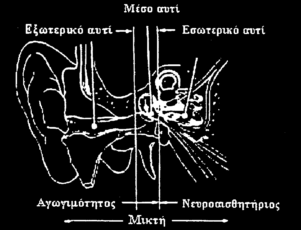 Τύποι και αίτια Βαρηκοΐας / Κώφωσης 2/2 Εικόνα 1: Οι τρεις