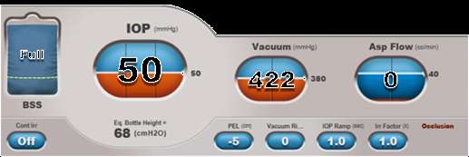 ACTIVE FLUIDICS 1. ACTIVE IRRIGATION 2. IOP SETTINGS o TARGET IOP o IOP RAMP 3.