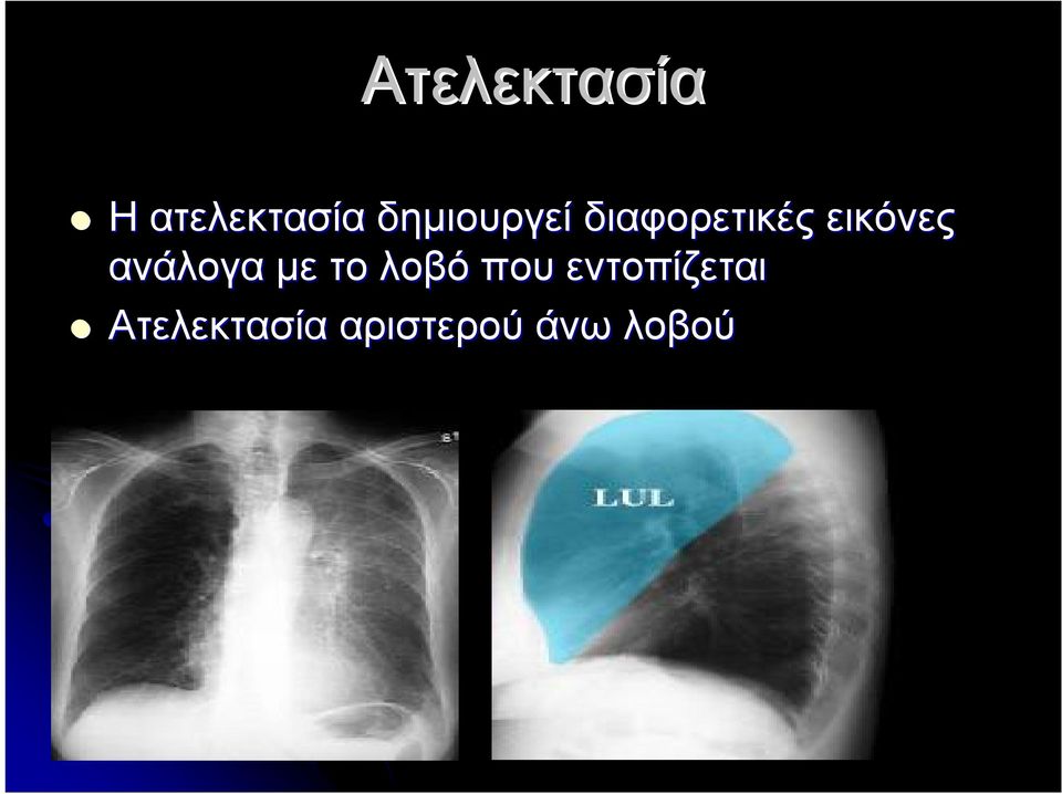 εικόνες ανάλογα με το λοβό που