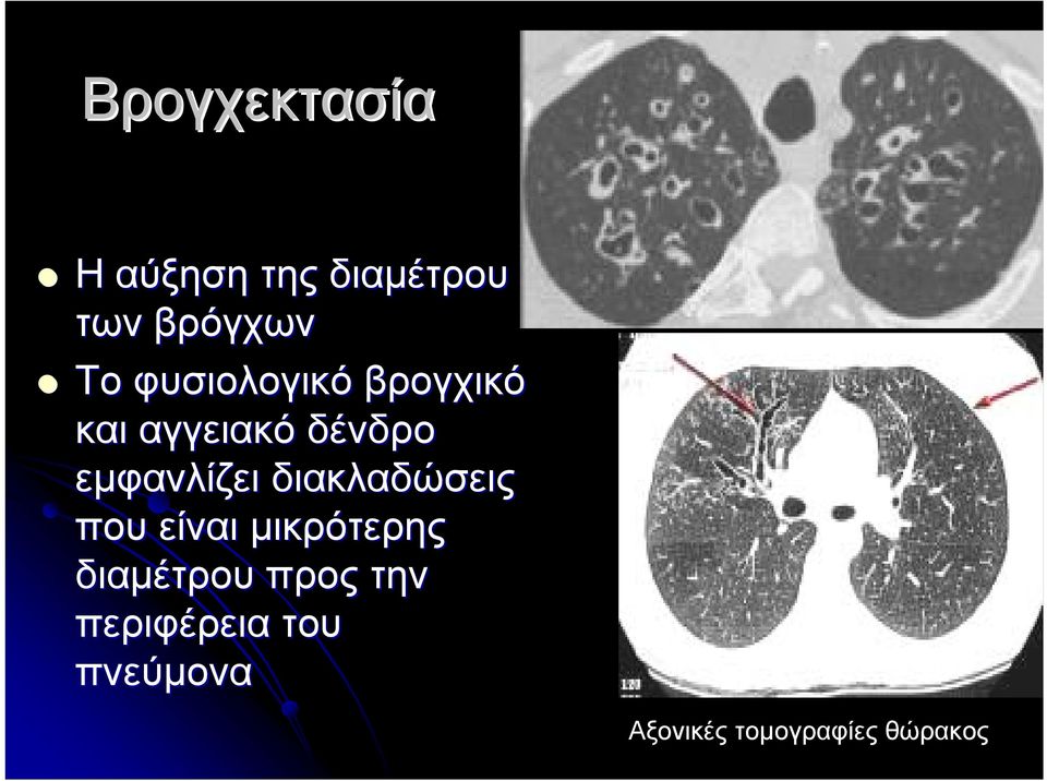 διακλαδώσεις που είναι μικρότερης διαμέτρου προς