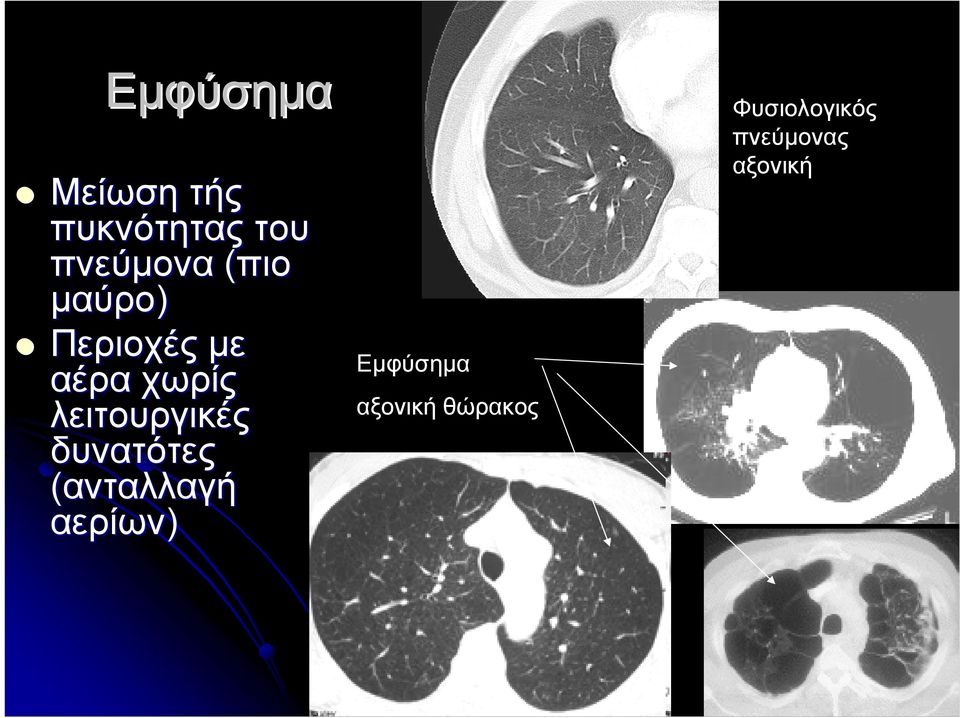 λειτουργικές δυνατότες (ανταλλαγή αερίων)