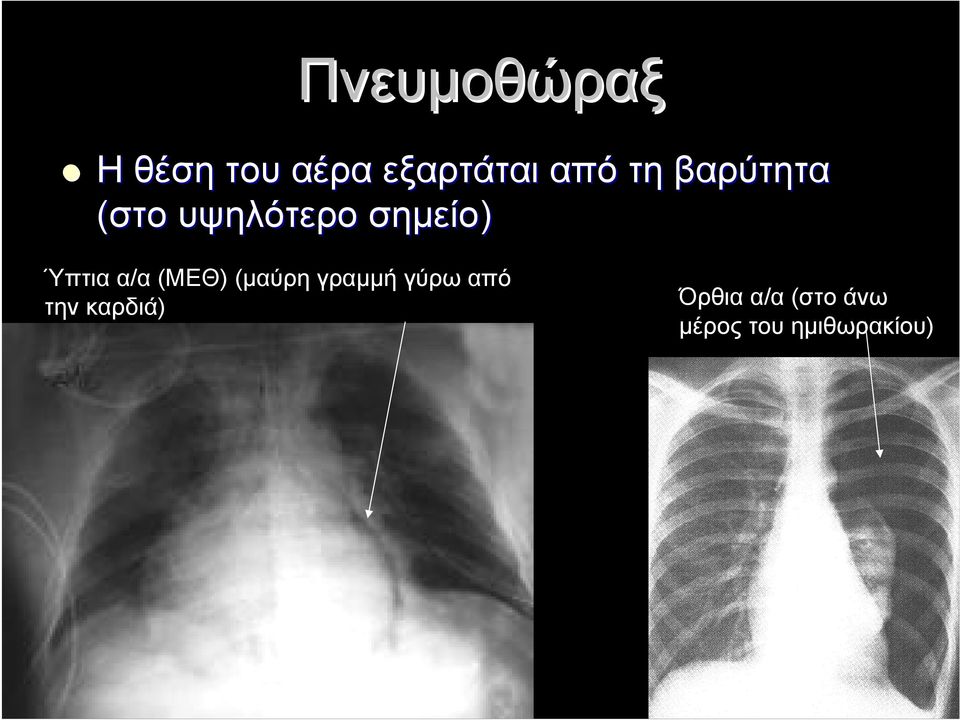 α/α (ΜΕΘ) (μαύρη γραμμή γύρω από την