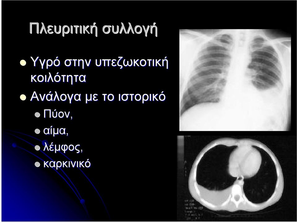 κοιλότητα Ανάλογα με το