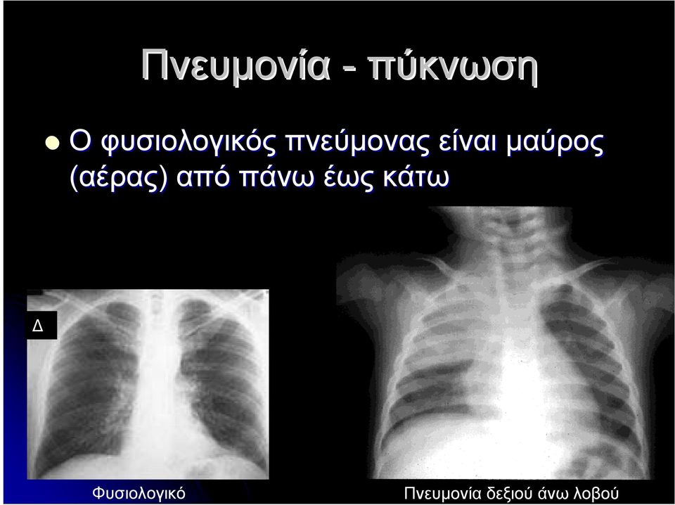 μαύρος (αέρας) από πάνω έως