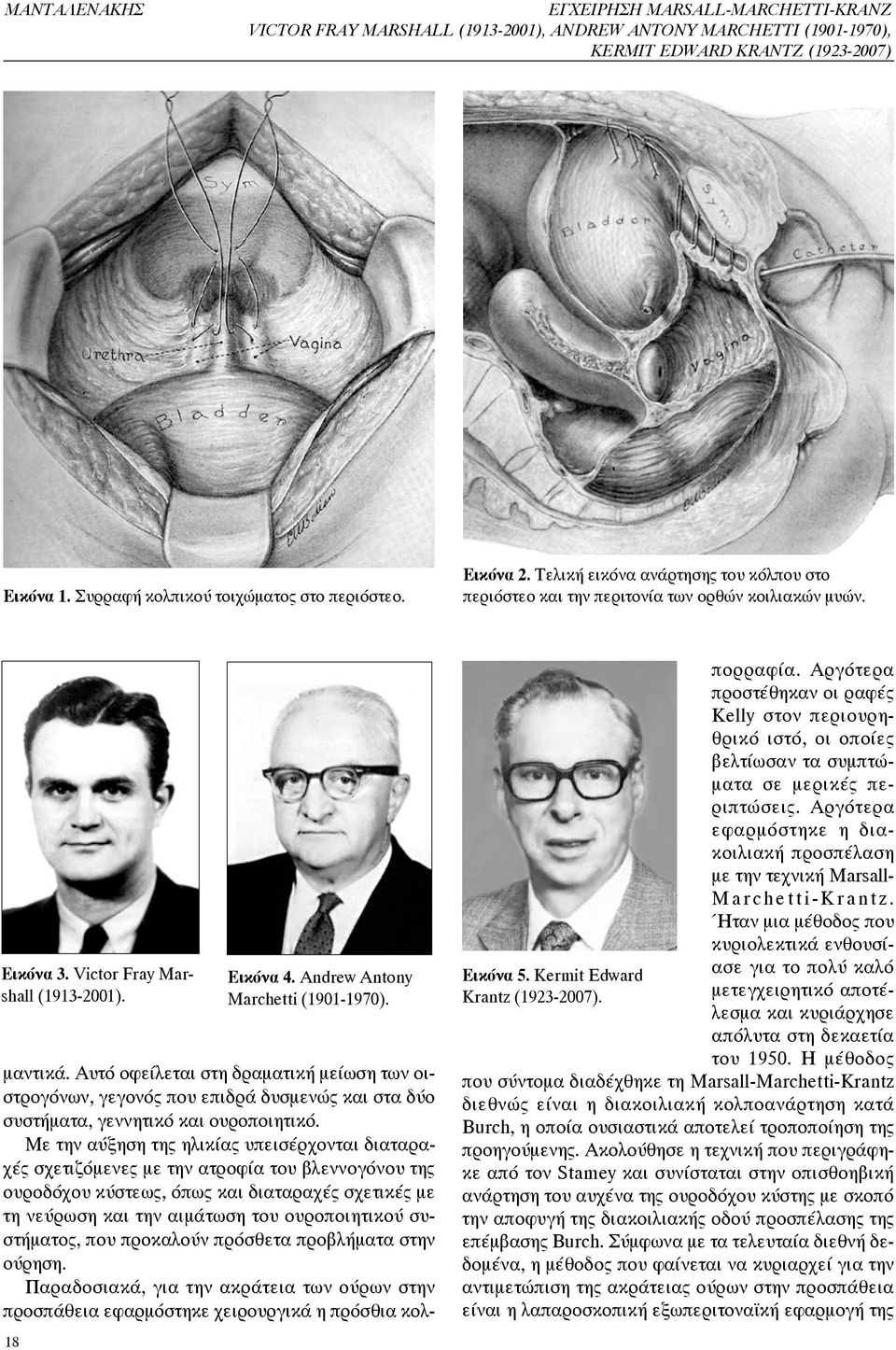 Kermit Edward Krantz (1923-2007). μαντικά. Αυτό οφείλεται στη δραματική μείωση των οιστρογόνων, γεγονός που επιδρά δυσμενώς και στα δύο συστήματα, γεννητικό και ουροποιητικό.