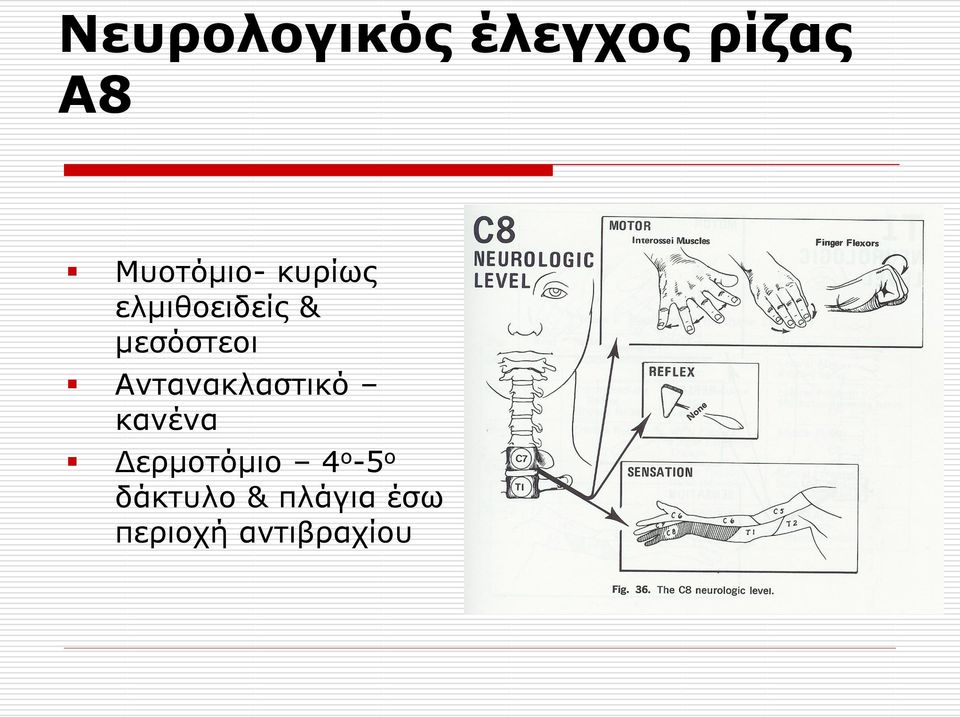 κεζόζηενη Αληαλαθιαζηηθό θαλέλα