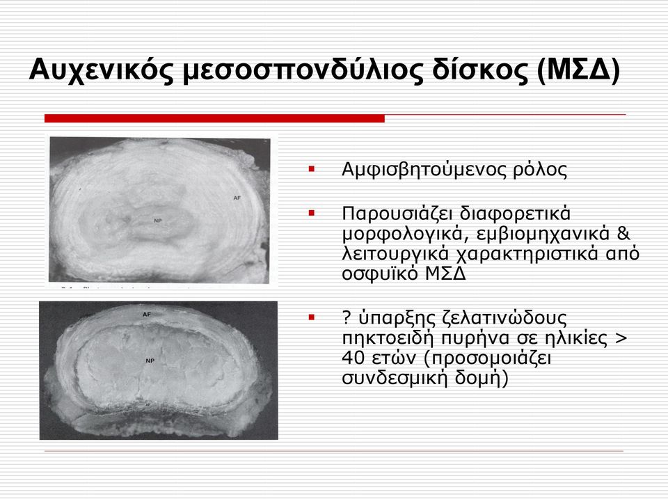 ιεηηνπξγηθά ραξαθηεξηζηηθά από νζθπτθό ΜΣΔ?