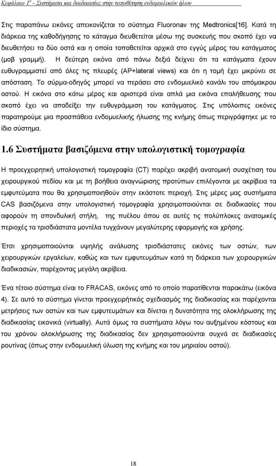 Η δεύτερη εικόνα από πάνω δεξιά δείχνει ότι τα κατάγµατα έχουν ευθυγραµµιστεί από όλες τις πλευρές (AP+lateral views) και ότι η τοµή έχει µικρύνει σε απόσταση.