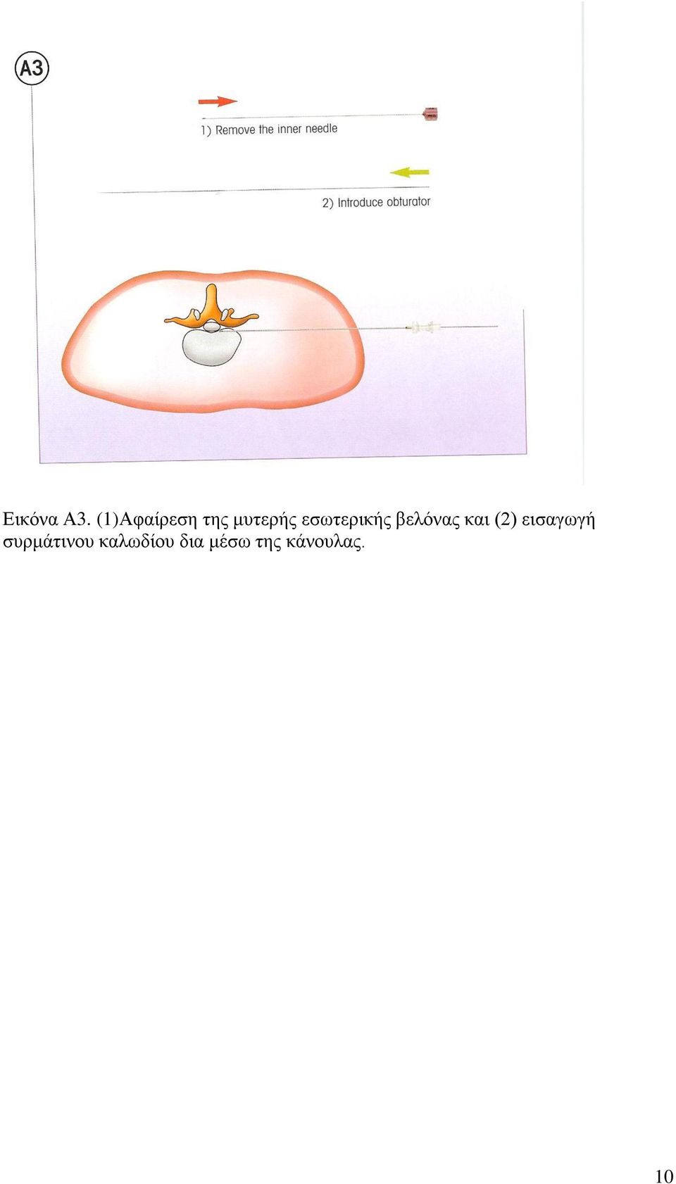 εζσηεξηθήο βειόλαο θαη (2)