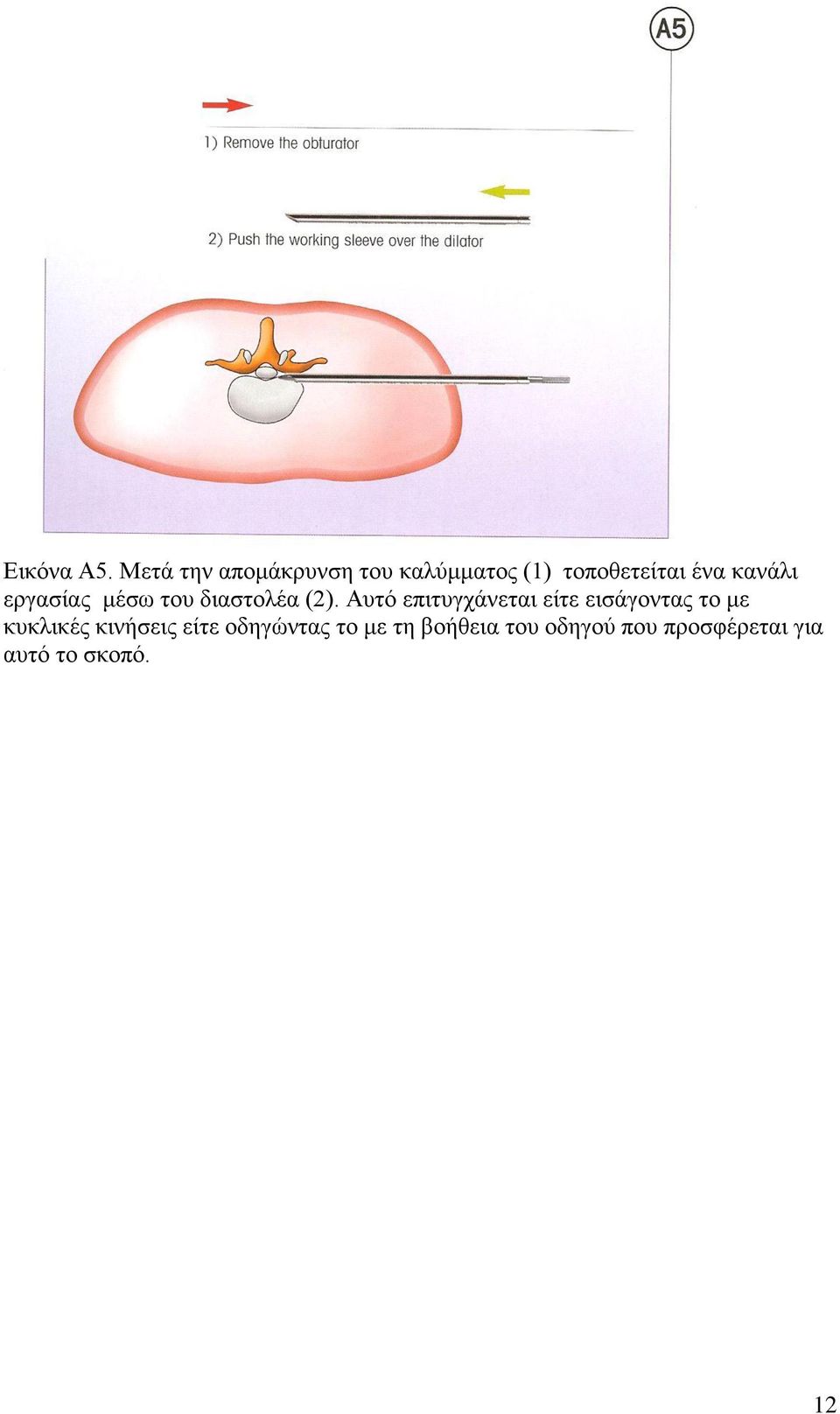 θαλάιη εξγαζίαο κέζσ ηνπ δηαζηνιέα (2).