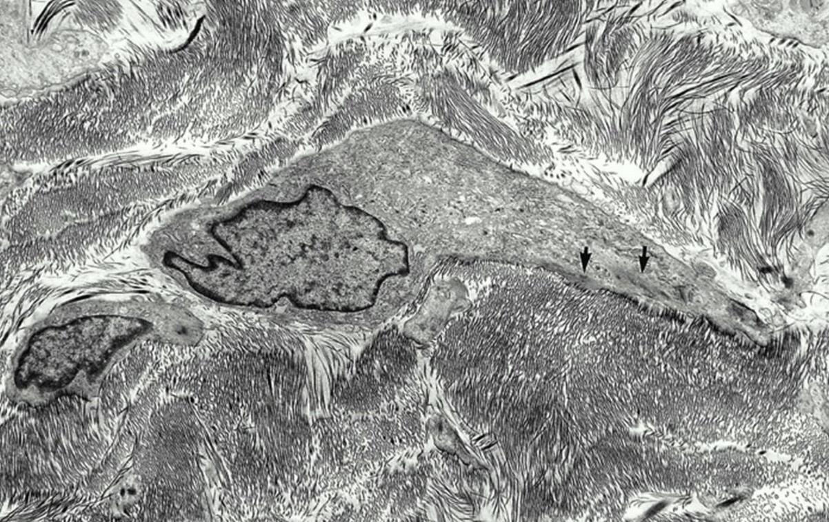 fibroblasta i glatkih mišićnih ćelija odsustvo lamine veoma zastupljeni