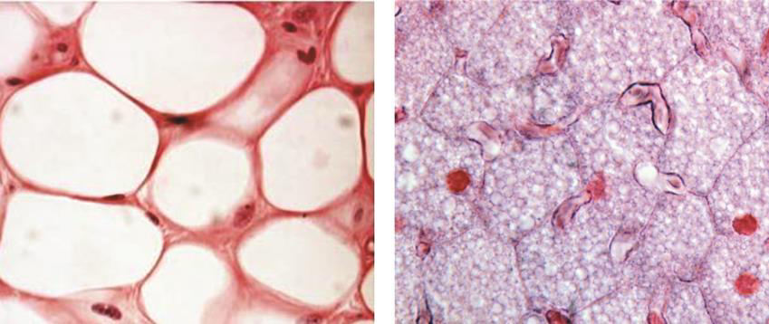 Specijalizovano vezivo tkivo Dominiraju ćelije adipociti U organizmu pojedinačne ili u grupama Masno tkivo jedan od