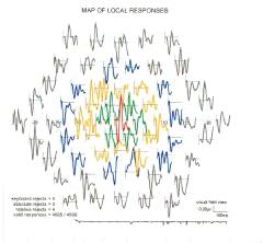 Εικόνα 14: Φυσιολογικό mferg (Movassat M, 2012) Εικόνα 15: